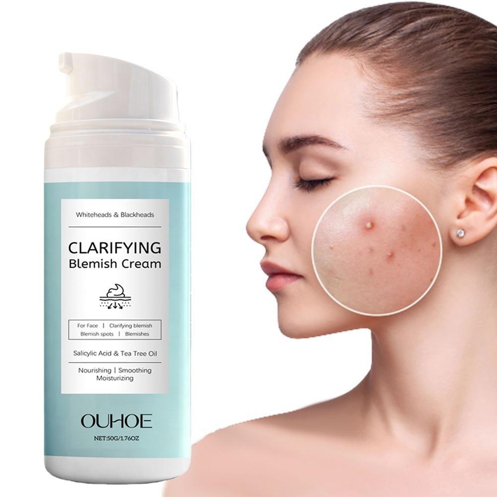 Azelaic Acid Cream - Salicylzuur gezichtscrème voor acne gevoelige huid
