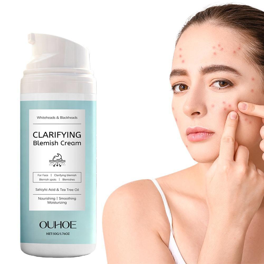 Salicylzuur gezichtscrème voor - Azelaic Acid Cream recensie en prijs