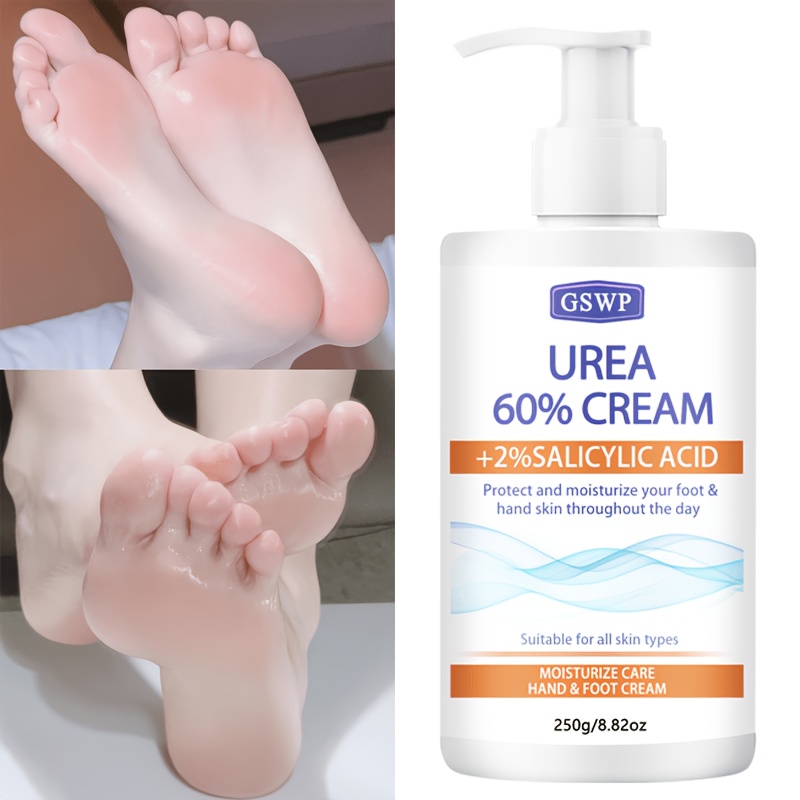 GSWP 60% Ureum Hydraterende Ha - Azelaic Acid Cream recensie en prijs