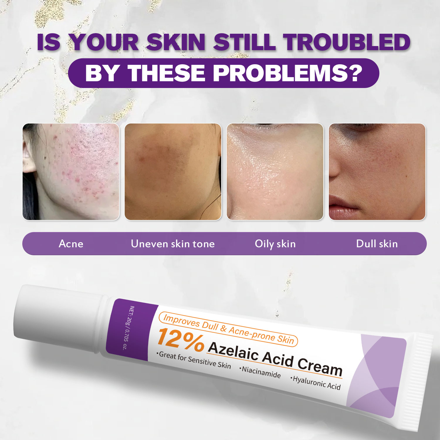 Milde Azelaïnezuurcrème verbet - Azelaic Acid Cream recensie en prijs