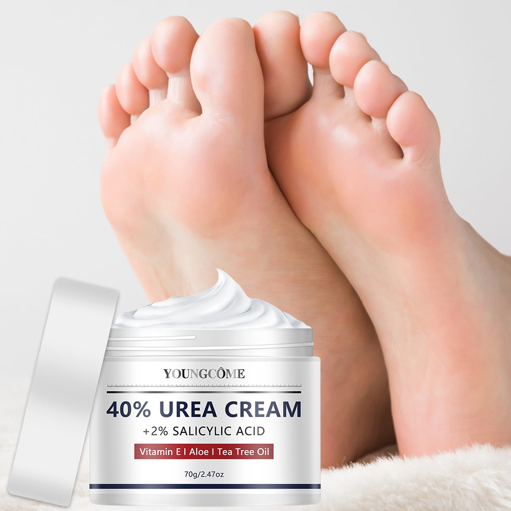 Ureecrème voor voet- en handve - Azelaic Acid Cream recensie en prijs