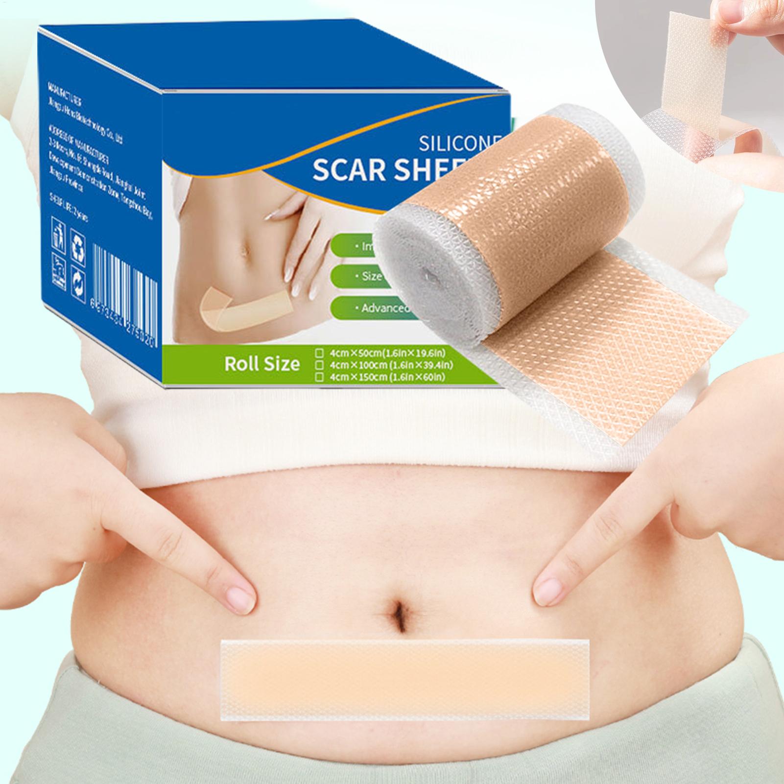 1 Rol Siliconen Littekenpleist - Skincare Collagen recensie en prijs